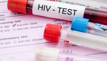 Калужане стали чаще проверяться на ВИЧ