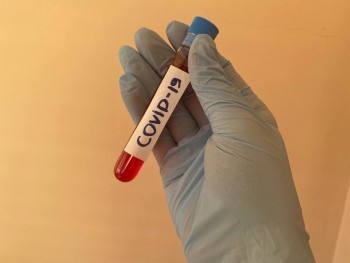 В Калужской области план по вакцинации от Covid-19 выполнен почти на 95%